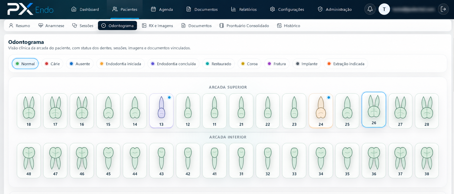 Odontograma do PX Endo organizado por dentes e status clínicos